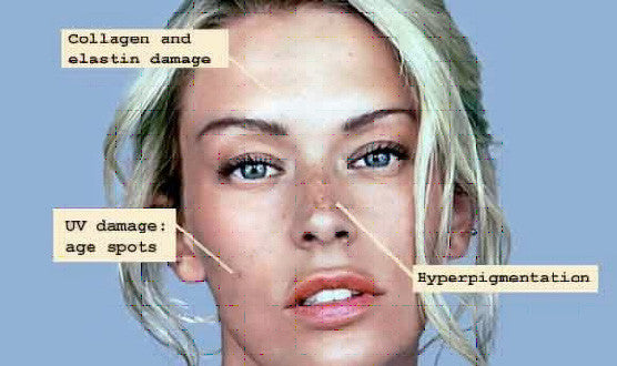 6 Vitamin C Serum Benefits for Youthful and Radient Skin
