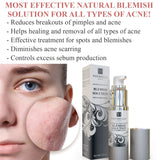 Voibella Blemish & Acne Spot Treatment Serum