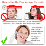 Voibella Pore Vacuum Blackhead Remover