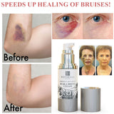 Voibella Scar & Bruise Cream 1 oz