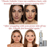 Voibella Blemish & Acne Spot Treatment Serum